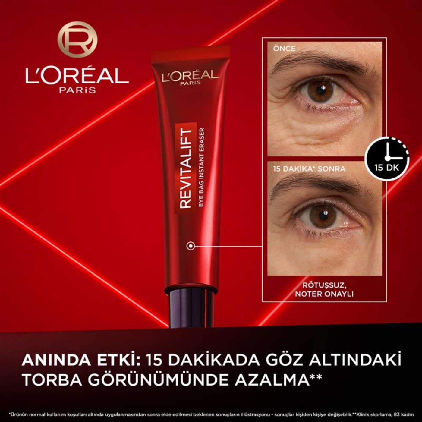L'Oréal Paris Revitalift Lazer Eyebag Göz Kremi Göz Altı Torba